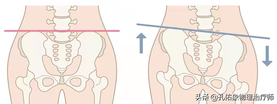 女性漏尿很严重是什么原因造成的,女性漏尿的原因及解决办法