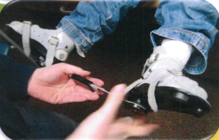 矫正鞋做法,马蹄足矫正鞋可调节