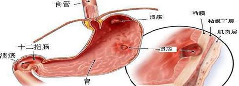 您真的了解糖尿病吗,胃痛的科普小知识