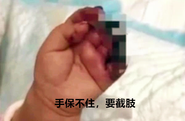 孩子被老鼠啃食原因是忘了擦嘴,婴儿被老鼠啃食事件