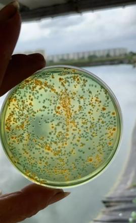 对虾养殖如何自己测弧菌,对虾水产养殖不花钱小妙招