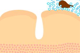 小气泡美容优惠券,小气泡美容护肤团购附近