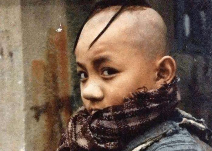 “三毛”34岁了！8岁爆火，14岁谢顶，植发挨300多针，如今变帅哥