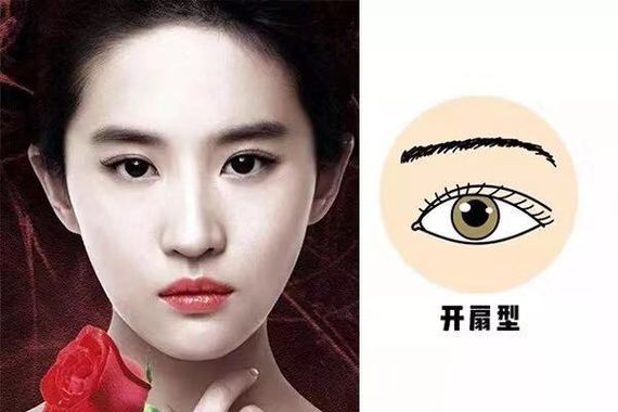 割双眼皮怎么变成内双了,割的双眼皮变成三角眼