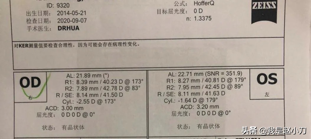 赵小刀白内障手术,先天性瞳孔残膜手术需要多少钱