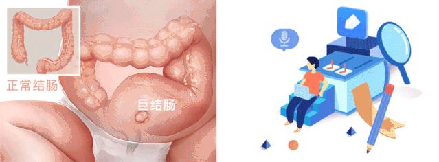 医疗科普便秘视频,科普便秘的预防