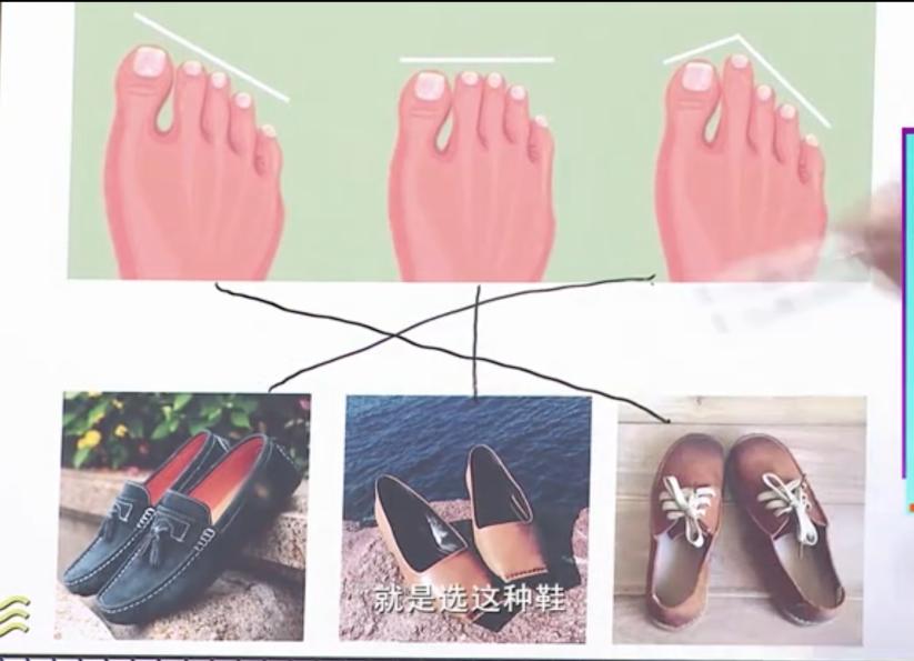 怎样选一款适合自己脚型的鞋,适合大脚骨穿的鞋测评