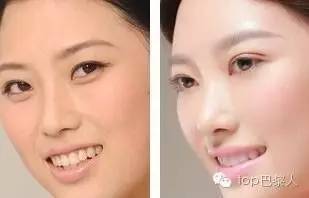 法国药妆哪个最好用,好用的法国淡斑药妆