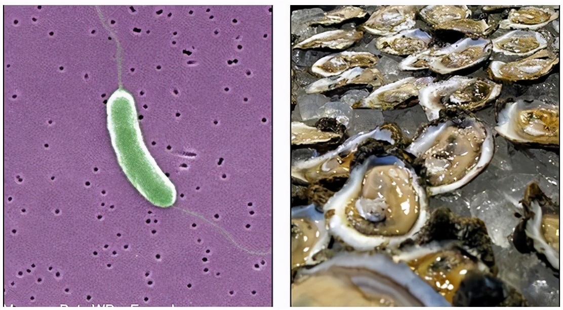 女子被福寿鱼刺戳伤手指险截肢,男子被鱼刺扎手竟需截肢才能保命