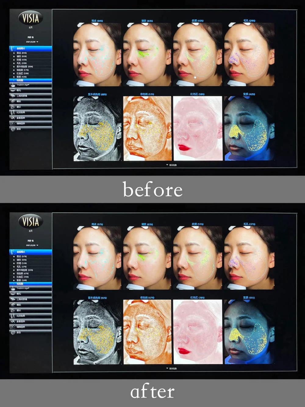 如何打造透亮质感的美肌,冬天美肌的最佳方法