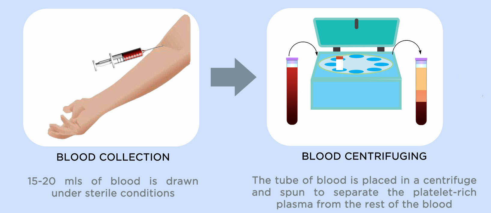 软骨损伤膝关节炎最好治疗方法,膝关节骨性关节炎修补