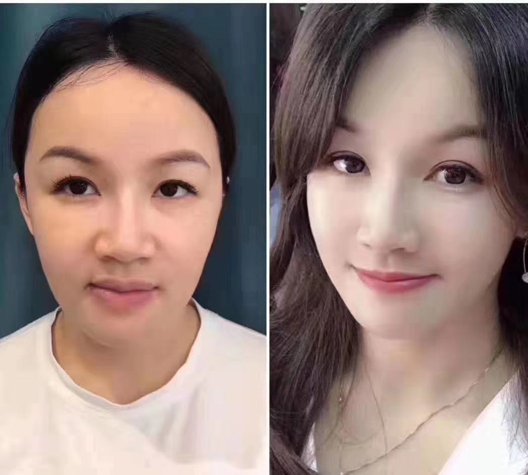 做线雕之前你需要先了解这些,做线雕之前你需要了解这几件事情