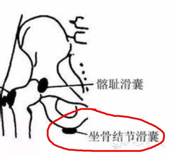 坐着屁股臀骨痛是怎么回事,坐了几十个小时屁股痛怎么办