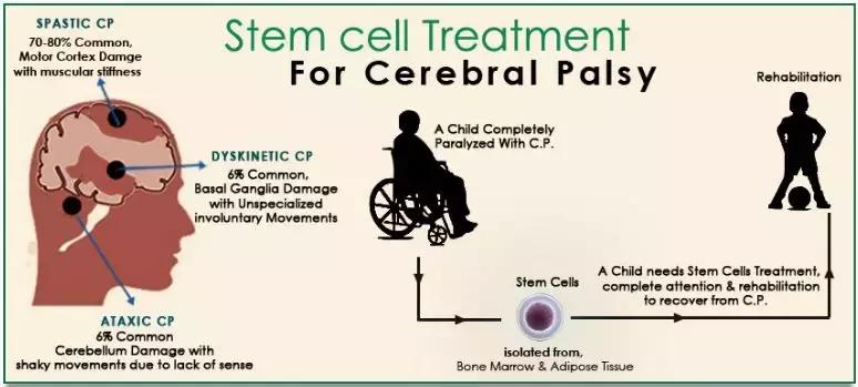 干细胞治疗帕金森病最新消息,2022年世界帕金森日主题视频