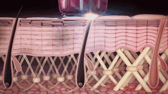 夏日脱毛攻略高效家用脱毛仪分享,脱毛必备好物脱毛仪