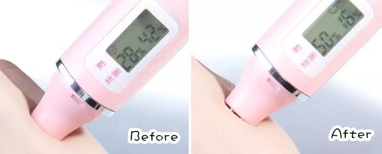 脂肪粒怎么用针挑出的,脂肪粒多久可以用针挑出来