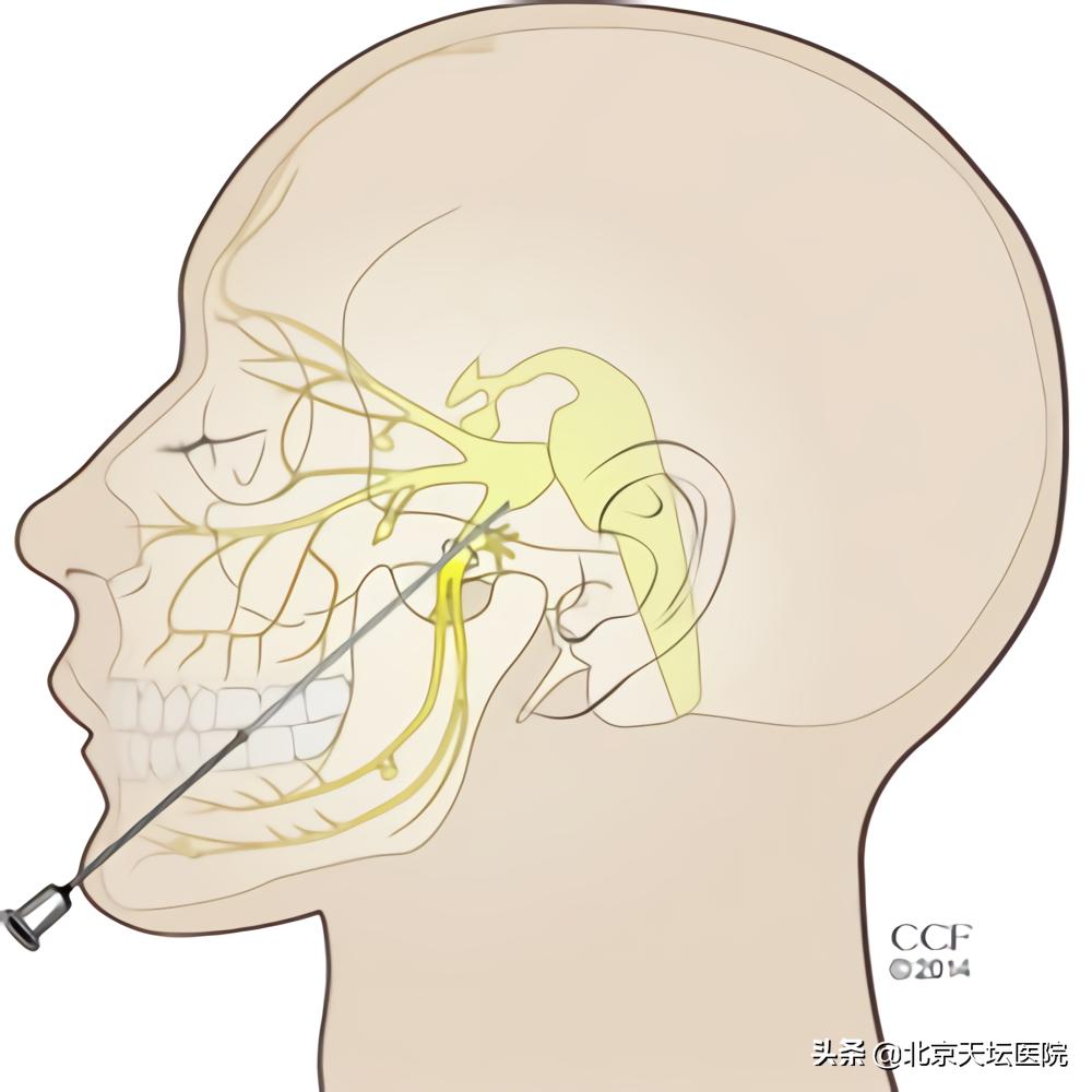 痛起来真的是要命,痛起来要命的病