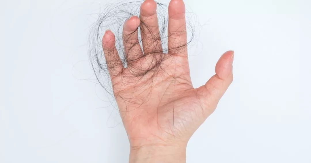 终于治好了脱发,脱发治好的亲身经历