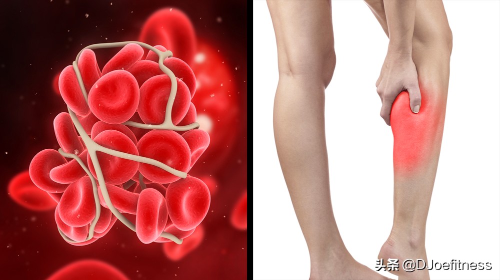 脚踝外侧肿最快的恢复办法,脚踝肿有什么感觉