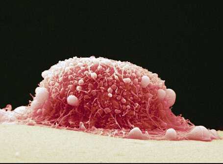 咨询一下坐月子中心费用能省多少？