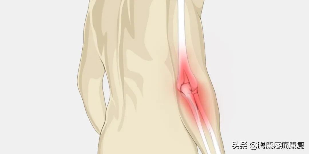 理疗对骨性关节炎有什么作用,骨性关节炎炎症怎么消除