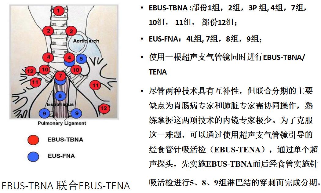 孙加源门诊,治疗肺癌的新技术新手段
