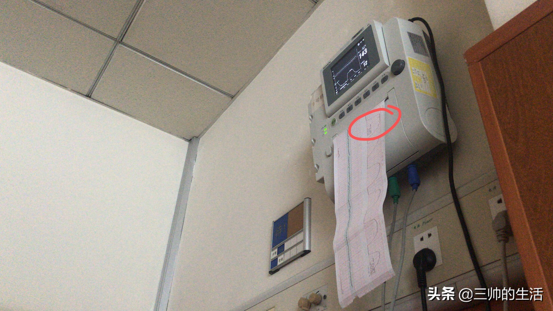 分享顺产日记，产程间打了两次无痛，原来最痛苦的不是分娩过程