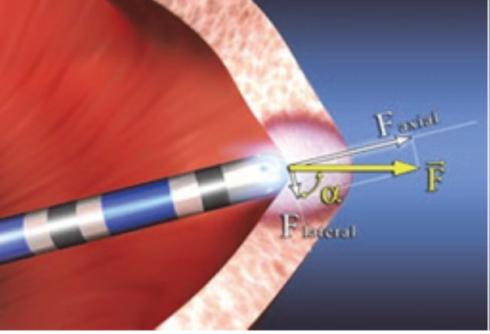 心律失常频发房性期前收缩,心律失常门诊故事