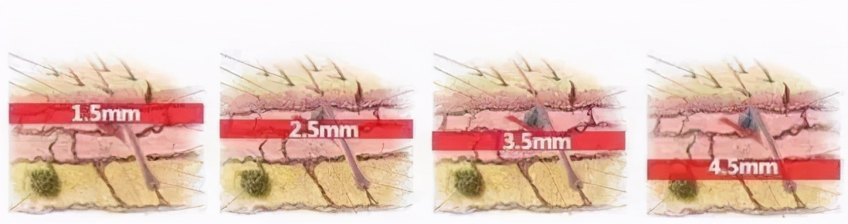 热拉提抗衰,抗衰老的杀手锏热拉提plus