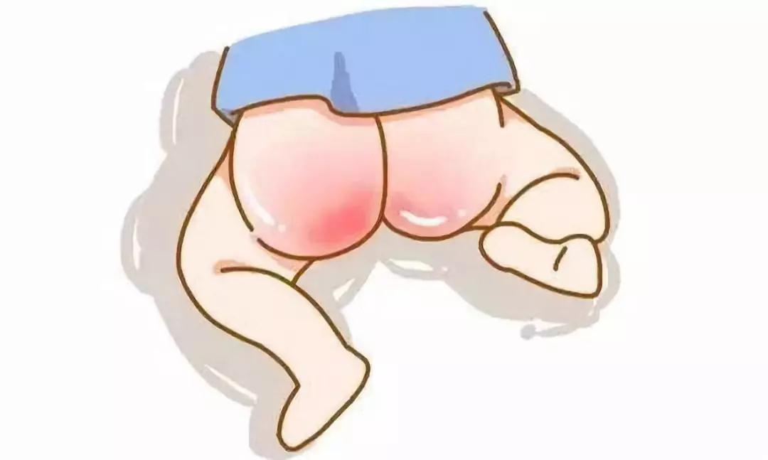 肛门潮湿是怎么回事吃啥中成药,肛门潮湿是怎么回事啊