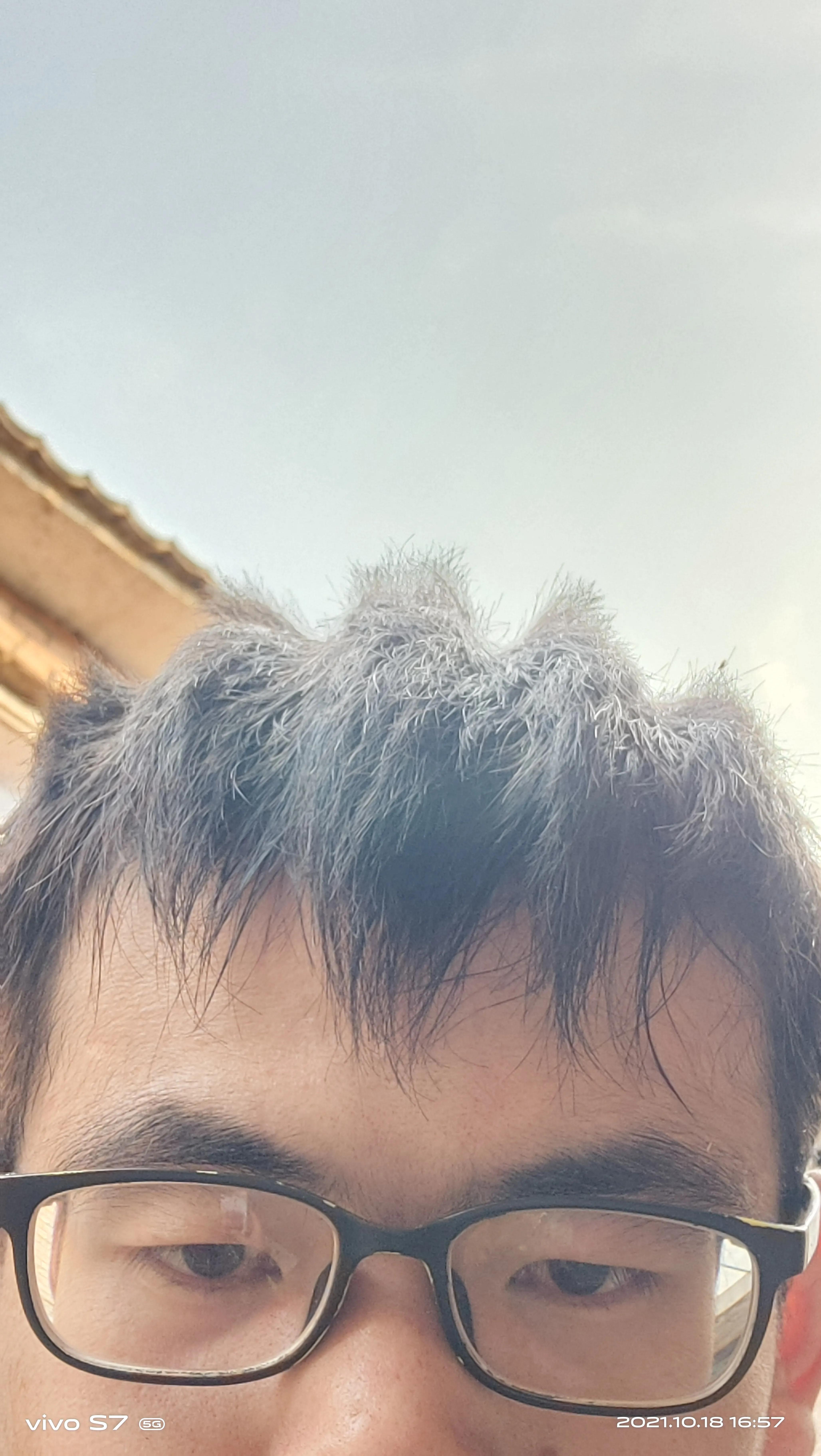 来令片怎么拆,来令片更换教程