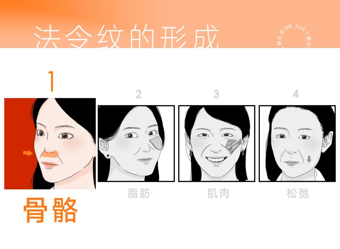 法令纹怎么改善脸部衰老,改善法令纹按摩手法视频