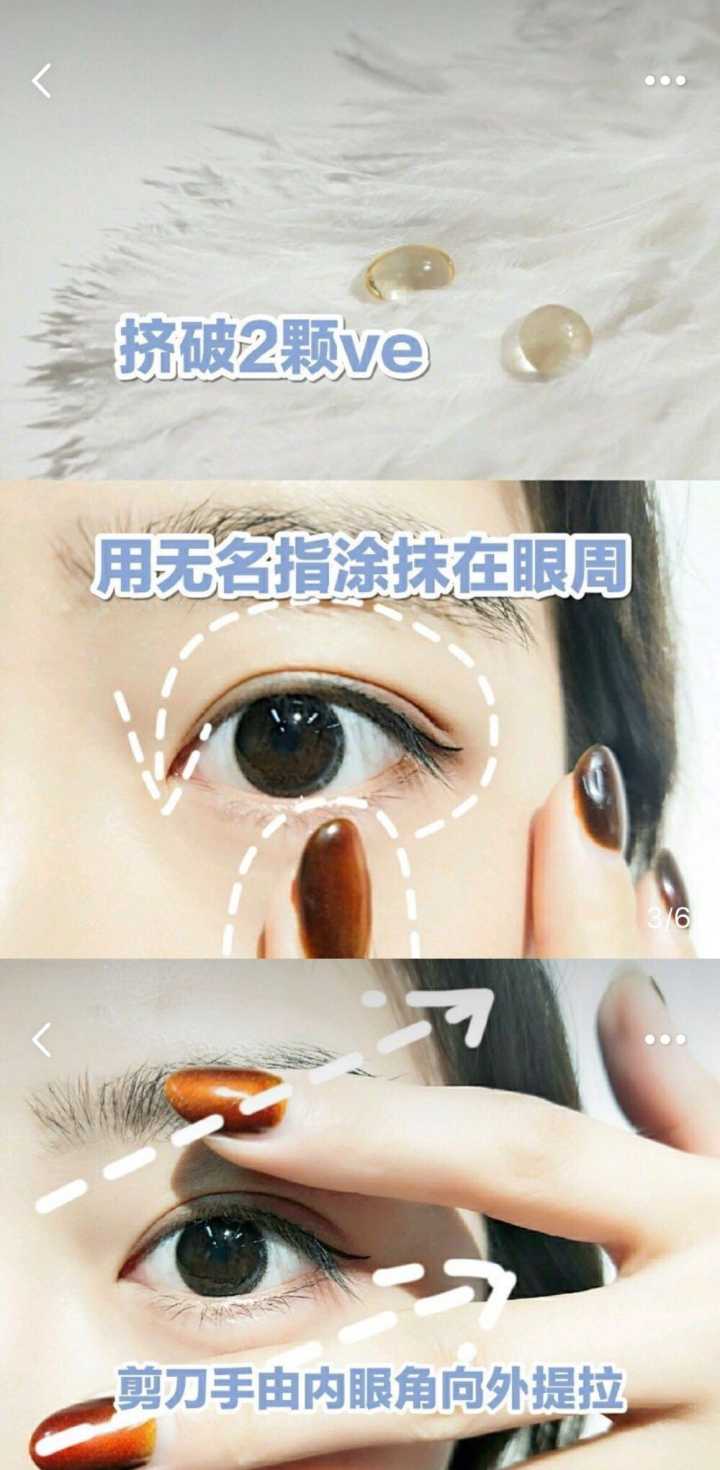 黑眼圈最快消除方法不用愁,黑眼圈去除最有效的方法推荐