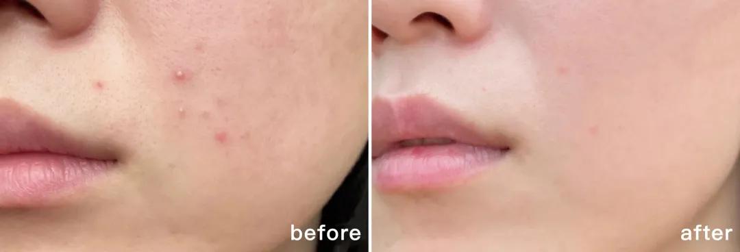 老国货祛痘真的有用吗,从明朝开始的国货