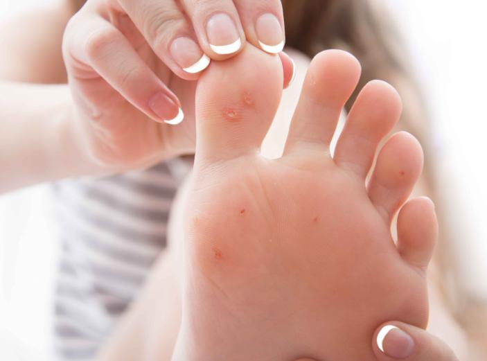 脚气不治后果,脚气不治咋样