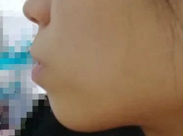 轻微嘴突正畸能达到正颌的效果吗,嘴歪正颌还是正畸怎么判断