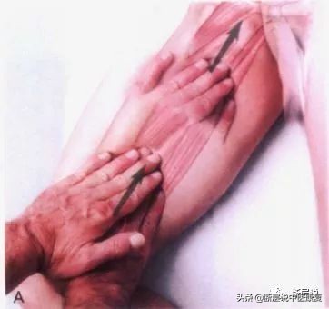 女性盆底健康问题,针刺要扎三阴交,手法要选内收肌