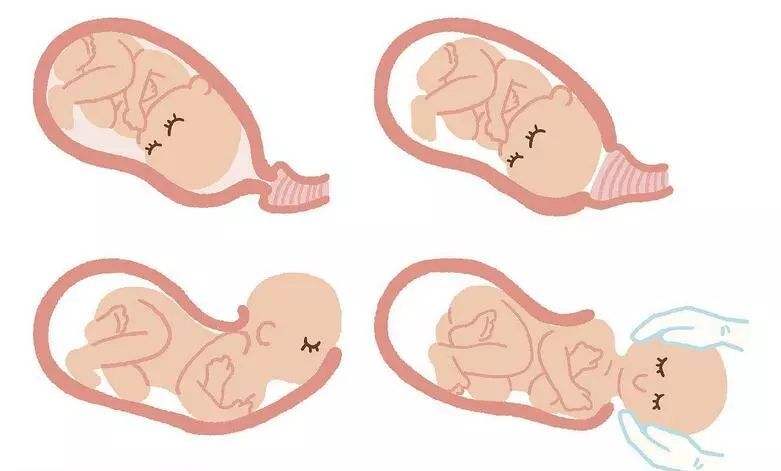 顺产时需要面对的6大尴尬,顺产妈妈的糟心事