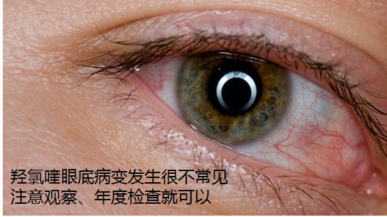 狼疮患者羟氯喹如何使用,羟氯喹治疗盘状红斑狼疮维持量