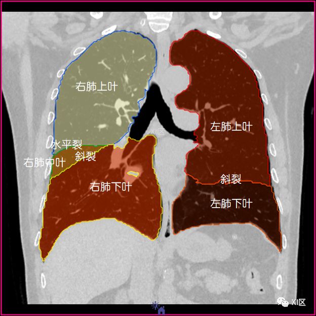 如此详细的肺部影像解剖，有点儿酷！
