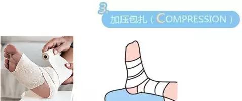 骨科医生治崴脚的日常,骨科林剑浩踝关节扭伤康复动作