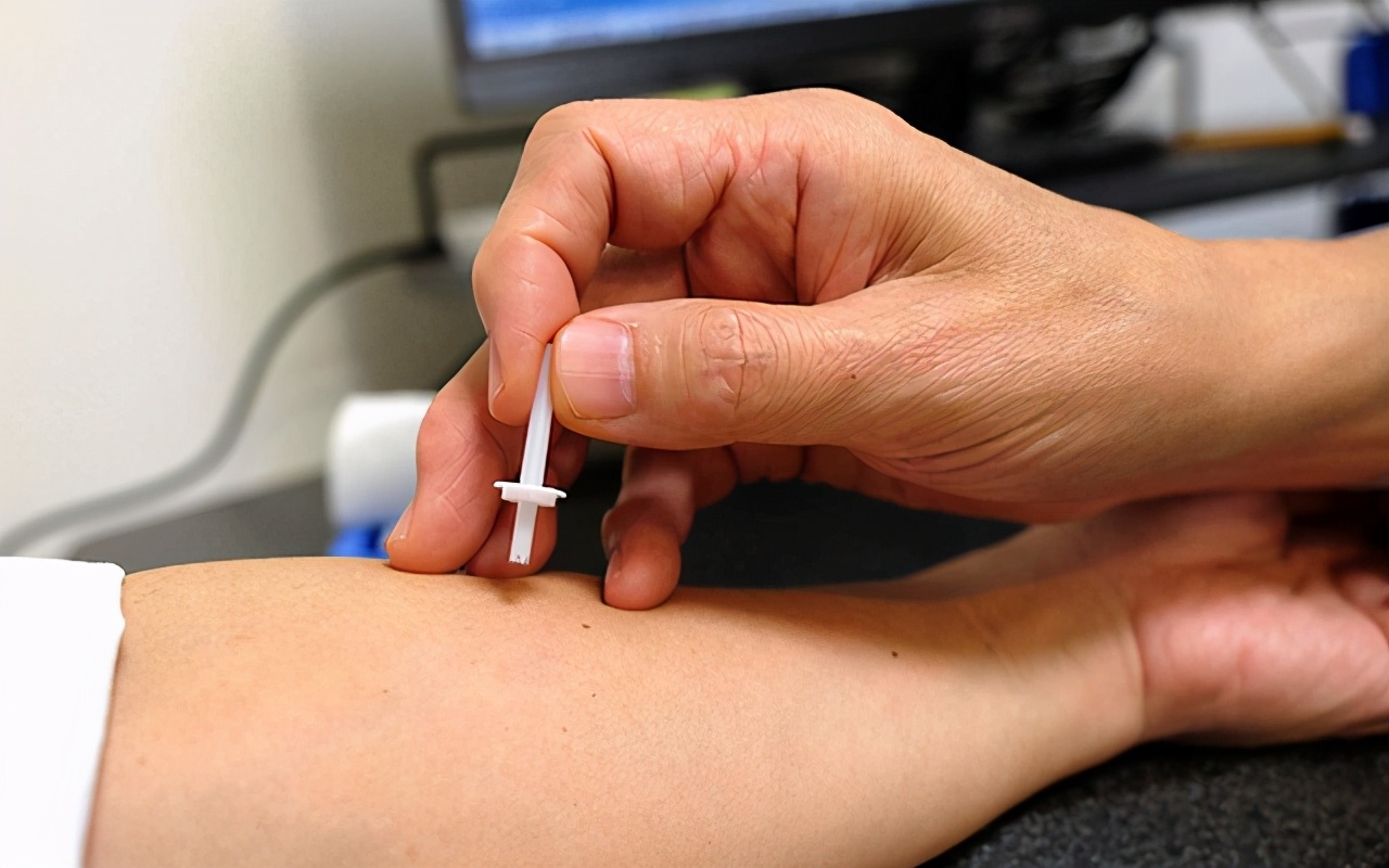 儿童过敏性紫癜是免疫系统疾病吗,过敏性紫癜属于自身免疫性疾病吗