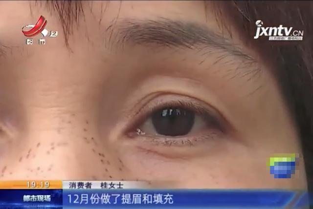 整形禾丽,禾丽整形医院失败案例