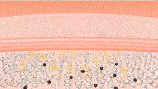 眼霜到底有没有用啊,眼霜里面有什么成分不能用