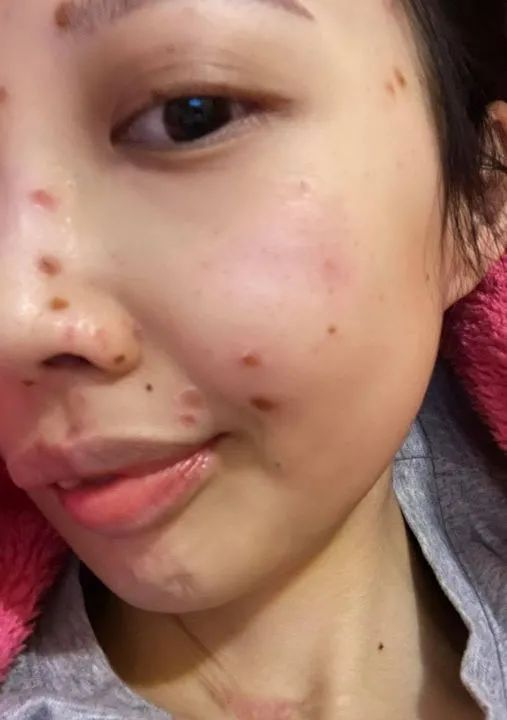 香港女明星癌症治愈 (香港女歌手抗癌八年放弃治疗)