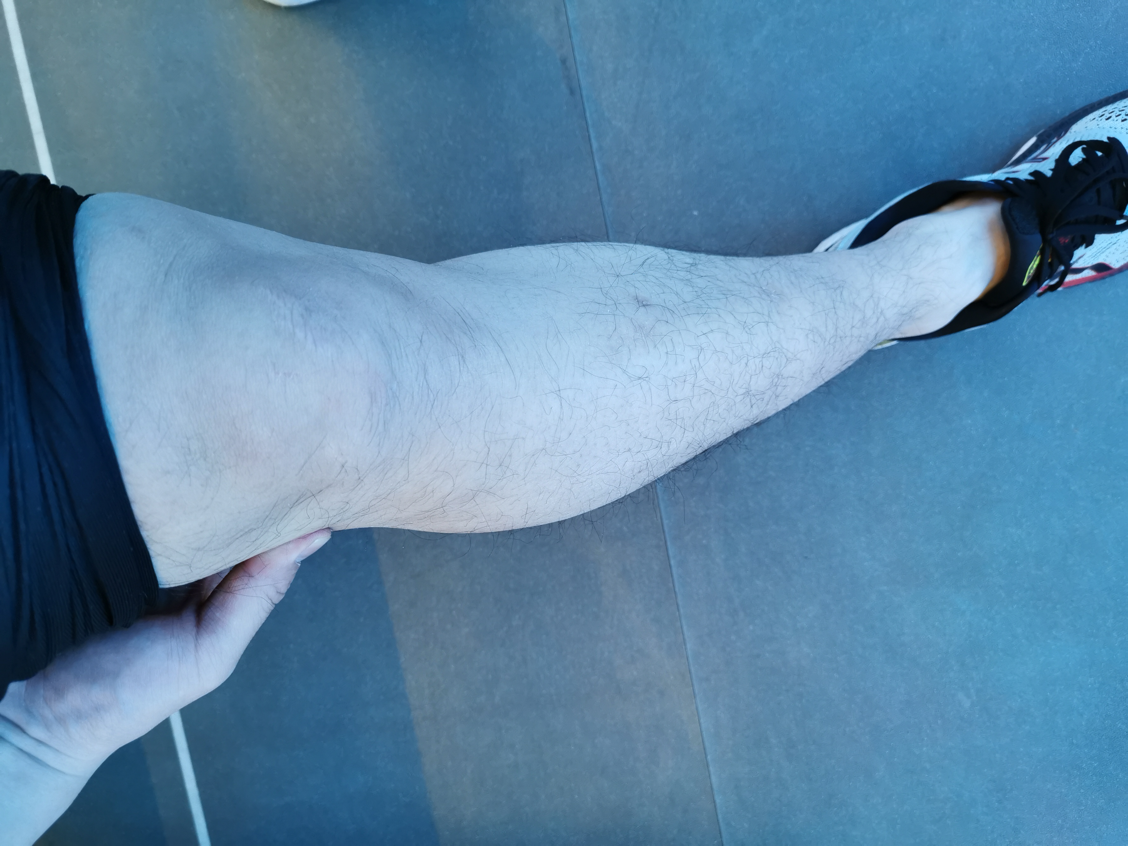 锻炼股腘肌用多少磅弹力带,跑步膝盖外侧髂胫束如何快速恢复