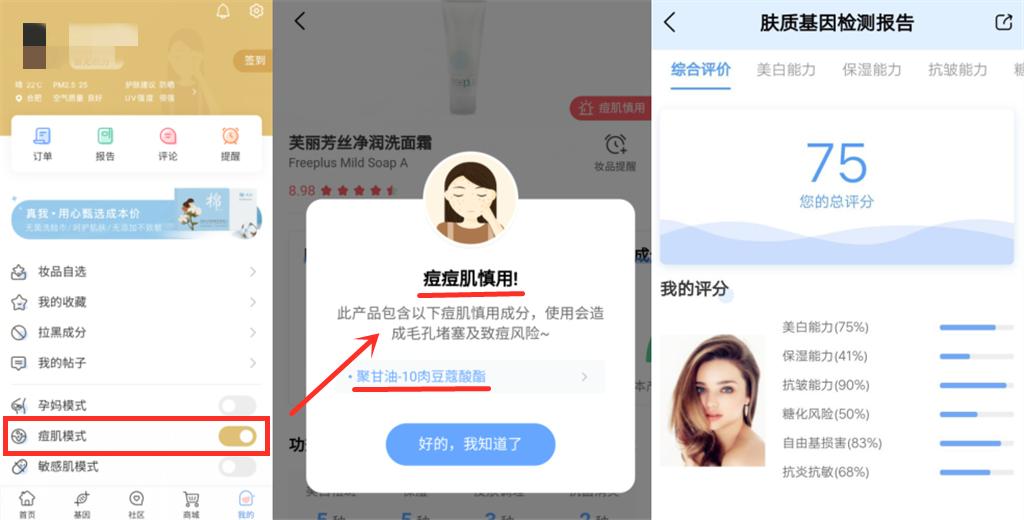 毛孔粗大爱长痘应该怎么改善,毛孔粗大怎么破