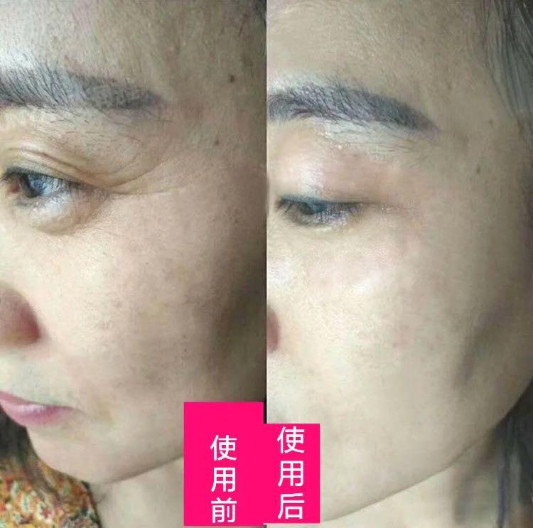 宁静皮肤怎么变白了,为什么明星的皮肤是光滑的