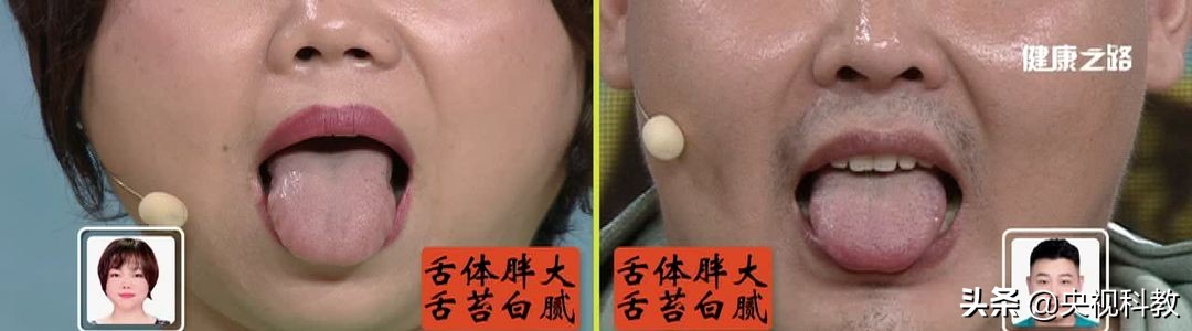 晚上打呼噜睡不醒,晚上翻来覆去睡不着是有痰湿吗