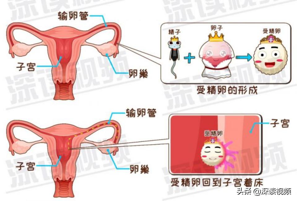宫外孕还来大姨妈怎么回事,陈旧性宫外孕是怎么回事